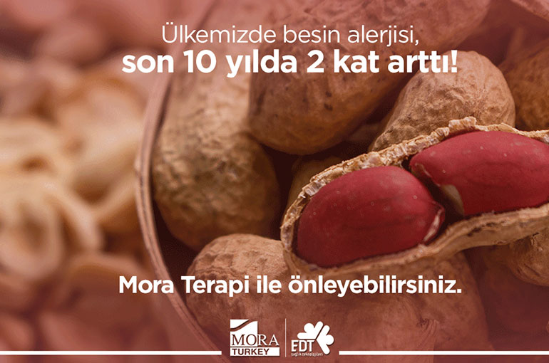 ALERJİ NEDEN BU KADAR YAYGIN?